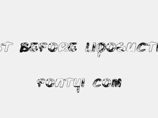 Just Before Liposuction